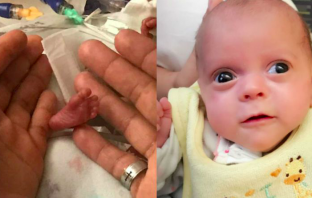 Baby Born Weighing 12 Ounces Finally Goes Home