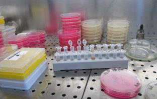 Scientists Grow Tiny Neanderthal Brains In Petri Dishes