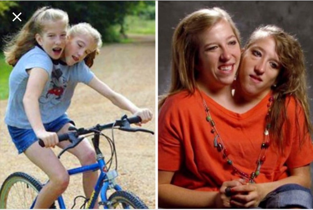 Famous conjoined twins Brittany and Abby get first job as 