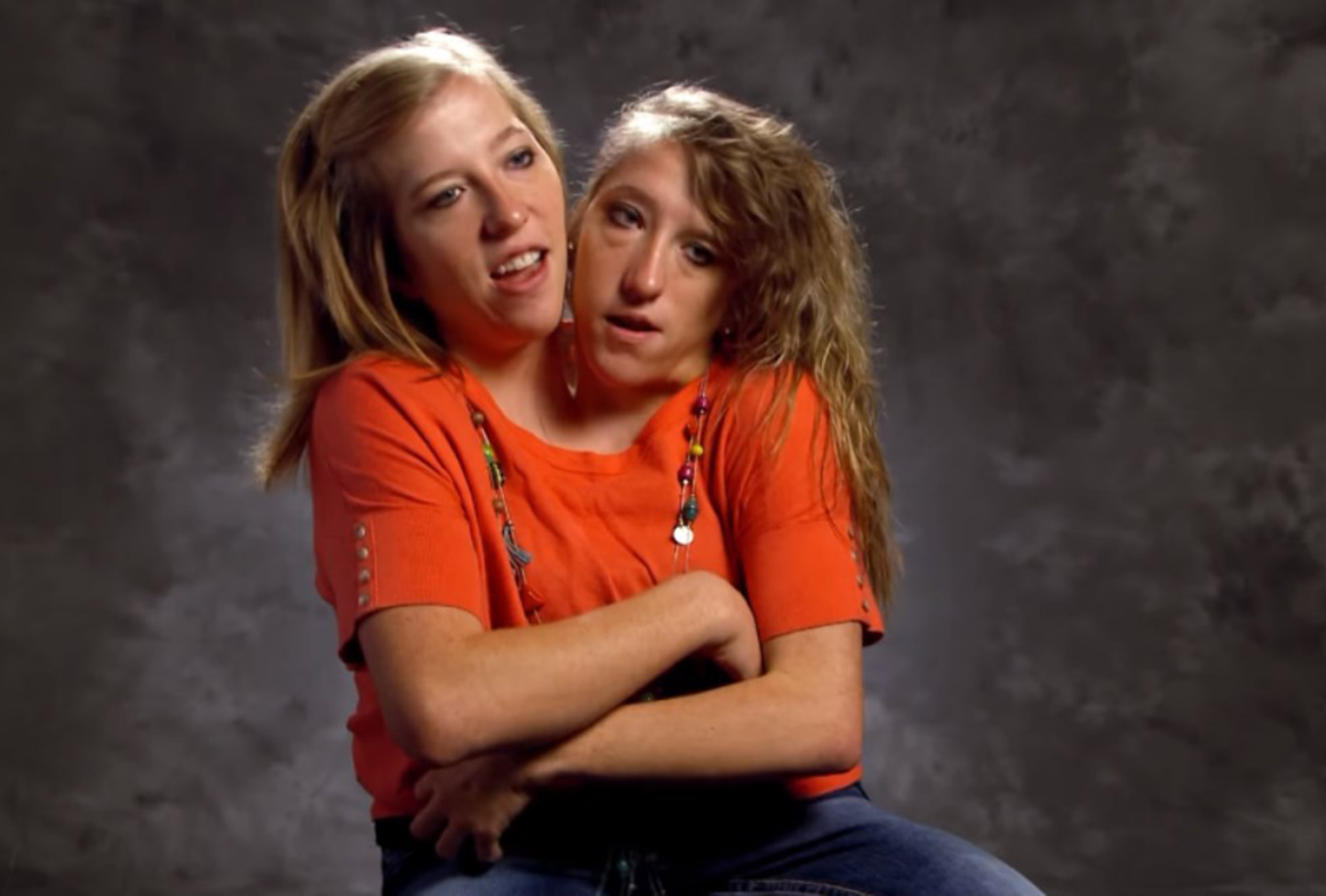 Conjoined twins brittany and abby bare all